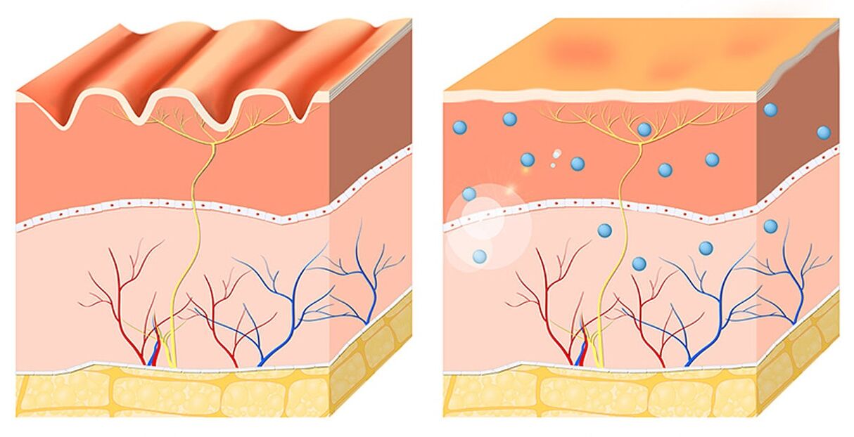 Inno Gialuron hidrata la epidermis de manera uniforme