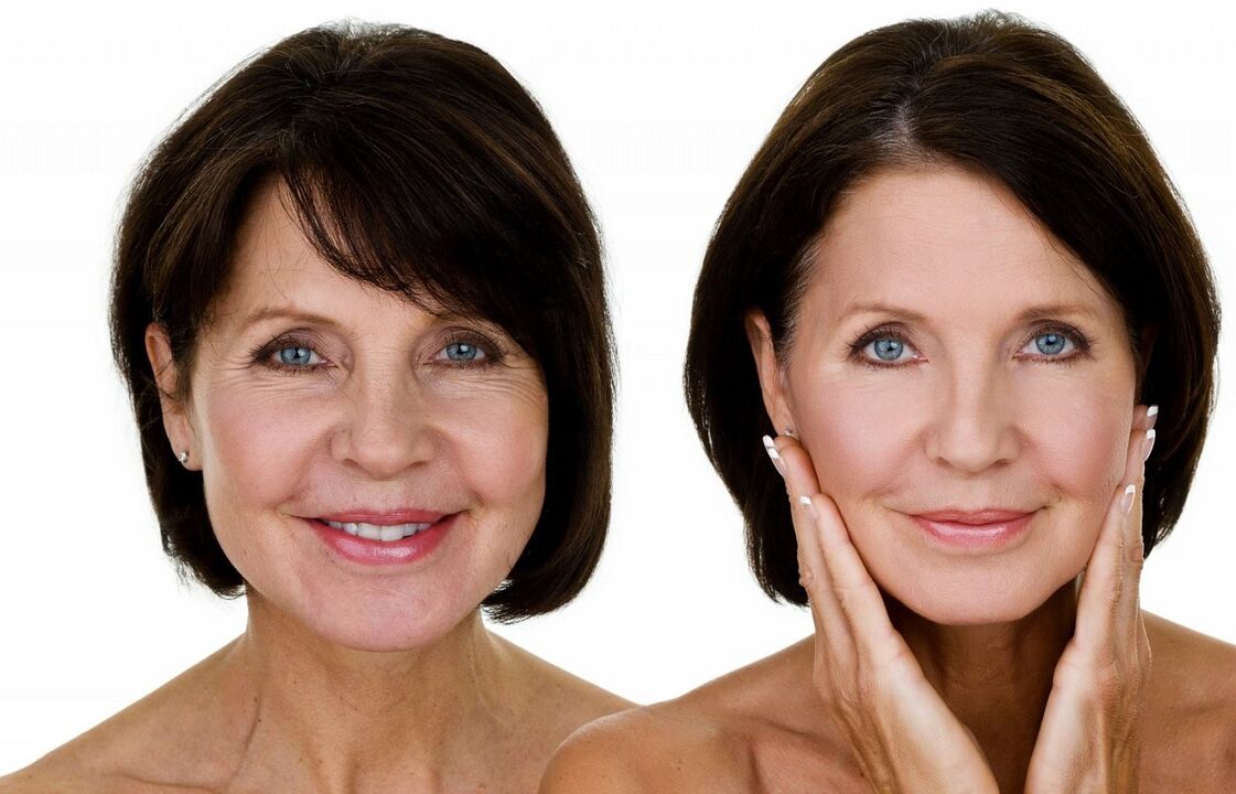 Avivencia de la piel facial