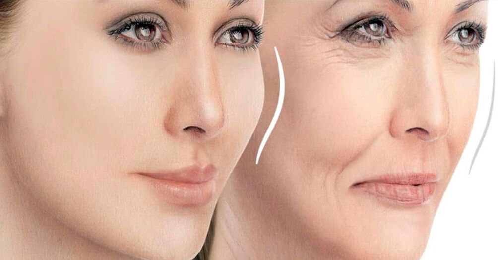 Rejuvenecer