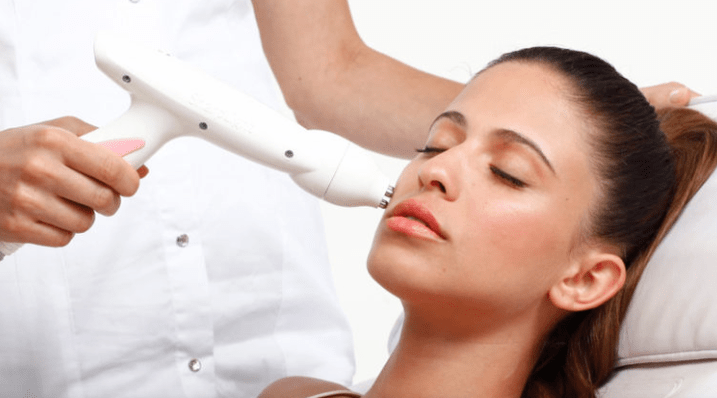 El láser de la cara rejuvenece la vitalidad
