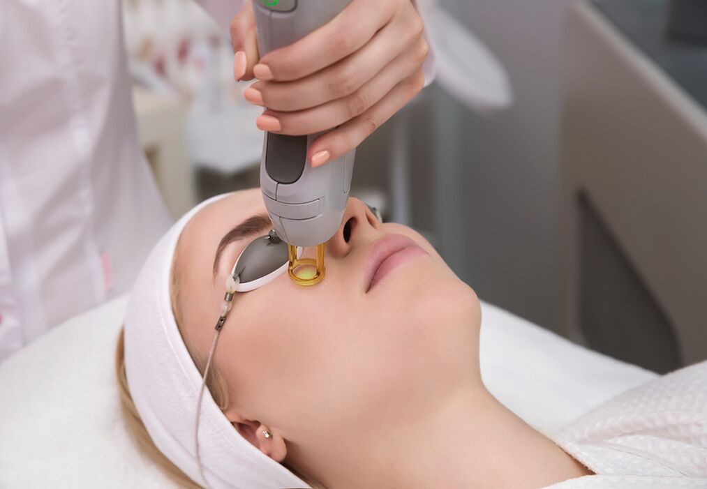 ¿Cómo se realiza el rejuvenecimiento con láser de la piel del contorno de ojos