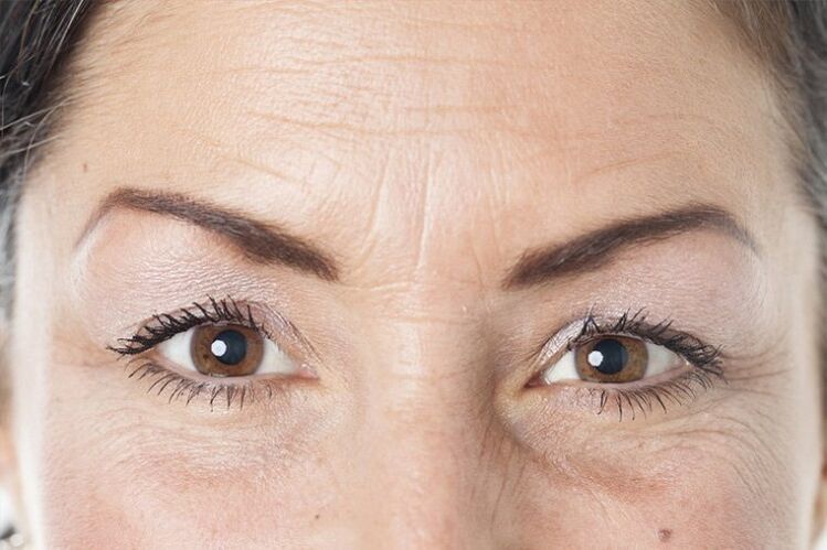 Causas del envejecimiento de la piel del rostro.